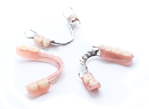 Removable Partial Denture